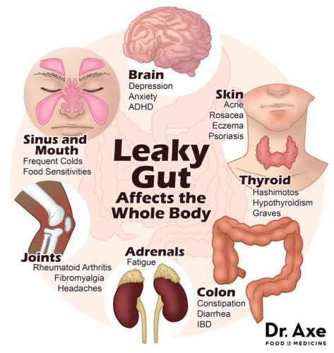 11 leaky gut